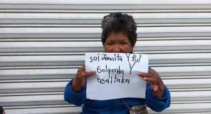 Juanita vive en situación de calle; fue asaltada y golpeada en Pachuca