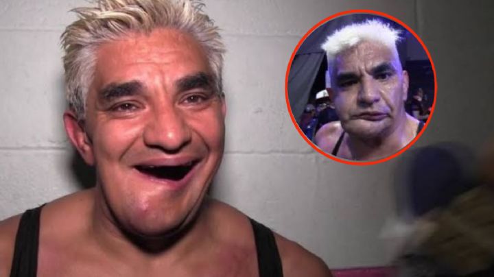 ¿Qué le pasó a Shocker en la cara?