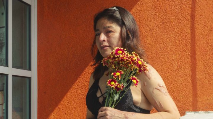 Sobrevivientes de violencia ácida exigen empleos dignos