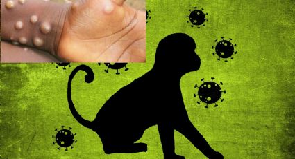 Los 12 estados con casos confirmados de viruela del mono