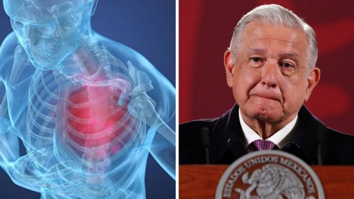 ¿Qué es la angina inestable que padece AMLO y qué tan peligrosa es?