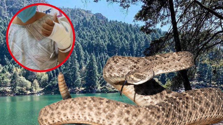 Víbora de cascabel muerde a turista durante paseo en El Cedral; vive para contarlo