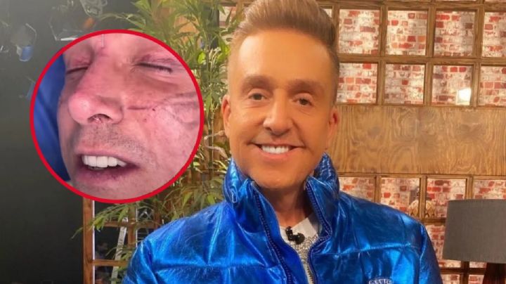 Daniel Bisogno, ¿qué le pasó que fue a parar al hospital, según dijo Paty Chapoy?