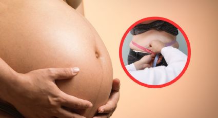Embarazo y sobrepeso: Así se puede ver afectado tu bebé