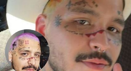 FOTO: Así quedó el rostro de Christian Nodal tras eliminarse los tatuajes