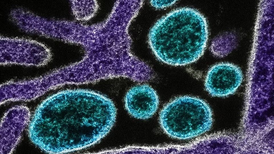 Nipah: ¿qué se sabe del virus mortal que tiene en alerta a India?