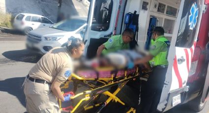 Vendedor de tamales pierde pierna al ser atropellado por un motociclista