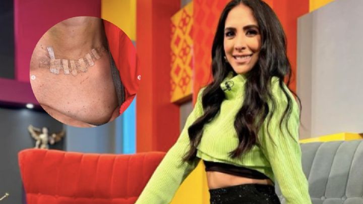 La verdad de Cynthia Urías y la operación que la tuvo varios días en el hospital