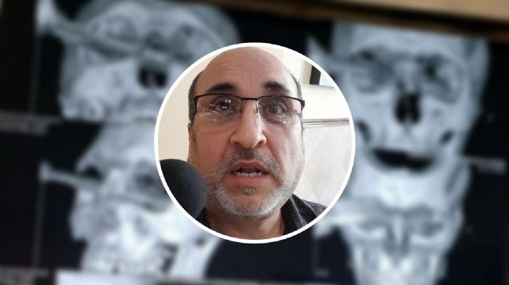 Perder el ojo me arruinó la vida: víctima de ataque con cuchillo en estacionamiento de Soriana Veracruz