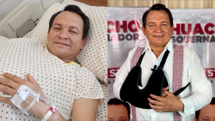 Elecciones en Yucatán: "Huacho" Díaz ¿se baja de la contienda tras lastimarse? Esto dice