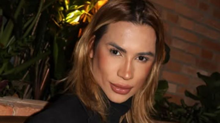 El foxy eyes: la cirugía estética que conquistó las redes y terminó en tragedia para el influencer Junior Dutra