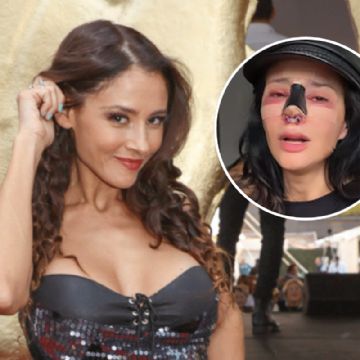 Foto descriptiva de: ¿Quién es Dorismar, la actriz que quedó desfigurada tras una cirugía?