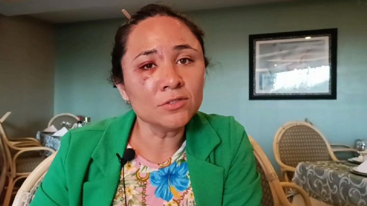 “Me golpearon el rostro”, Rocío denuncia agresión en marcha del 8M en Pachuca