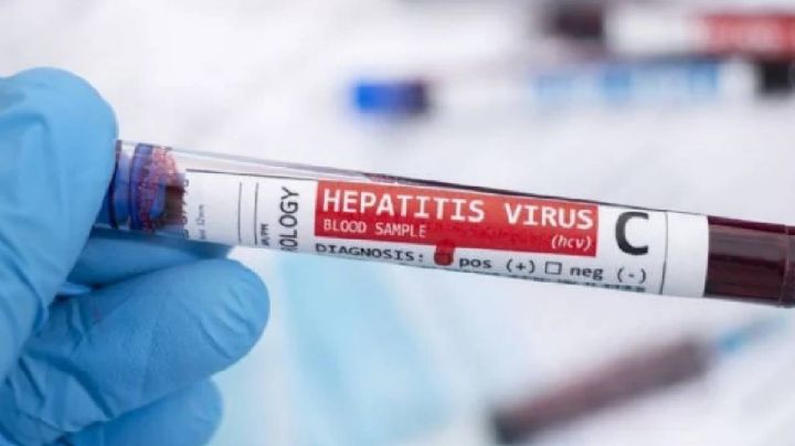 Jalisco: detectan 60 casos de hepatitis C en Los Altos
