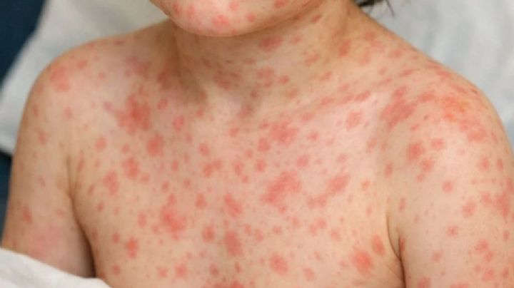 Brotes evitables: el costo de un Estado ausente