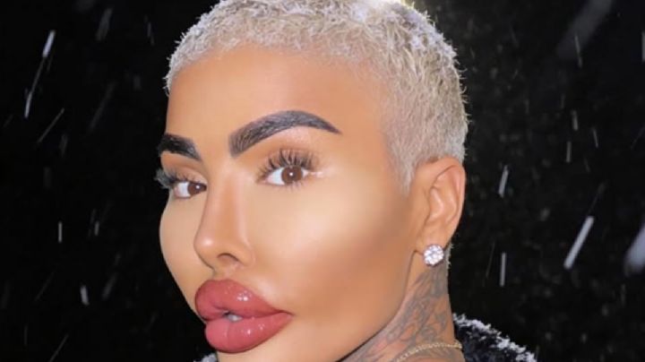 Muere influencer que se hizo 50 cirugías para parecerse a Kim Kardashian