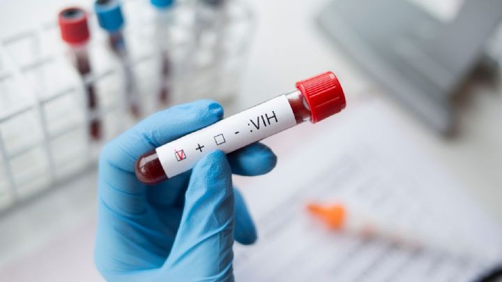 La lucha contra el VIH ante la muerte de ONUSIDA