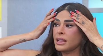Galilea Montijo revela qué le pasó en el rostro y explica la razón de su inflamación