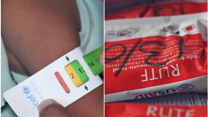 Wahida venció la desnutrición: la historia con la que UNICEF busca salvar a miles de niños