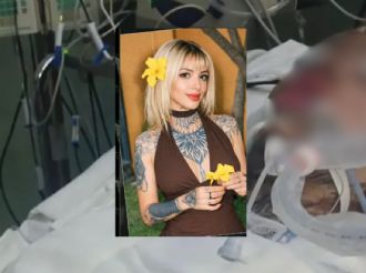 Sandi sigue luchando por su vida a un mes de ser atacada con ácido por Alison