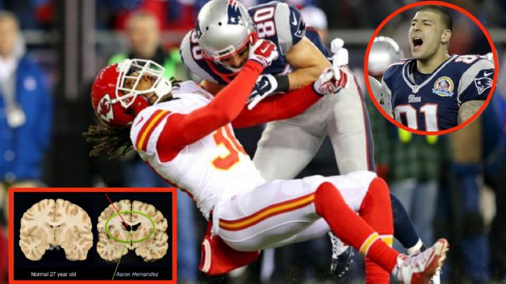 El terror que la NFL ocultó: la enfermedad mental que llevó al suicidio a jugadores de futbol americano