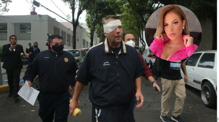 Adame podría perder un ojo y la pachuqueña Magaly Chávez ofrece ayuda