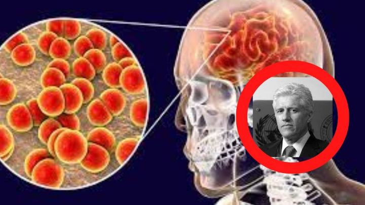 Crisis de Meningitis en Durango; Dr. Macías habla al respecto