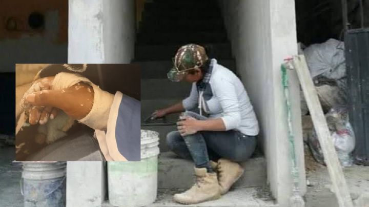 Ayuda para Saredi: albañila de Xalapa busca apoyo tras fracturarse la mano