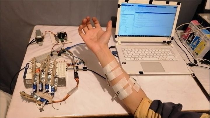 Crean prótesis de impulsos bioeléctricos para mejorar la calidad de vida de personas amputadas