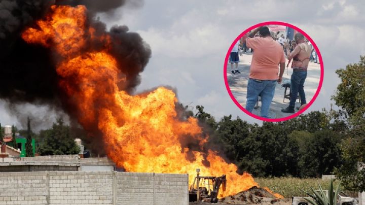 Muere hombre víctima del flamazo del 12 de noviembre en Huehuetoca