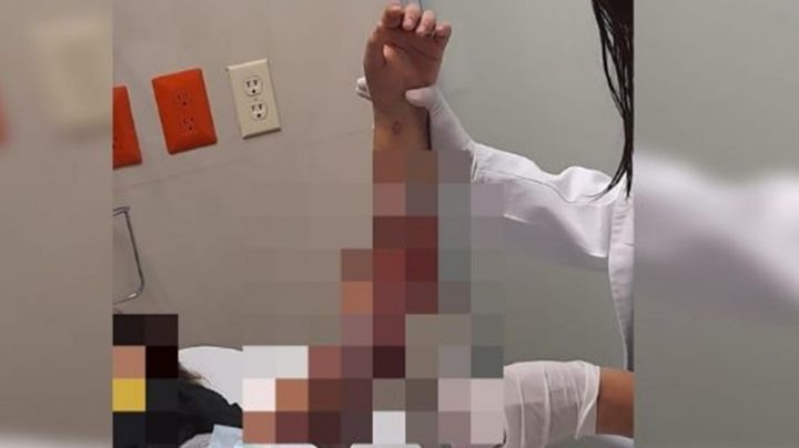 Queman a niña de 11 años en albergue; le rocían alcohol y la someten con taser