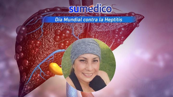“Sin saberlo, tuve hepatitis durante 12 años. Cuando llegué al hospital tenía cirrosis”