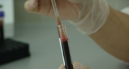 Como “muestra de amor”, adolescente se inyecta sangre de su novio con SIDA