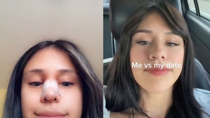 Cacha infidelidad de su novio y para perdonarlo, lo obliga a pagarle cirugía estética