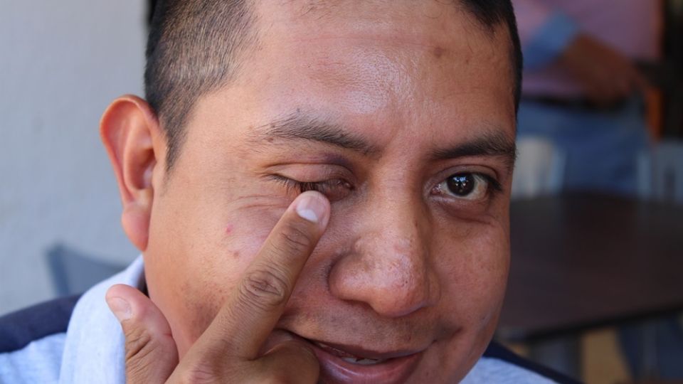Víctor Moisés Pérez teme por su vida, pues aparte de ser agredido físicamente, el presidente municipal de Huitiupán, Carlos Mario Montejo, lo amenazó de muerte