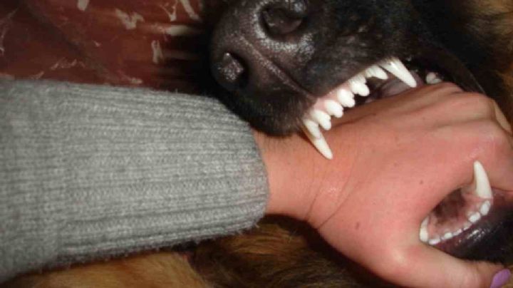 En Hidalgo al día se registran ocho mordeduras de perros en promedio