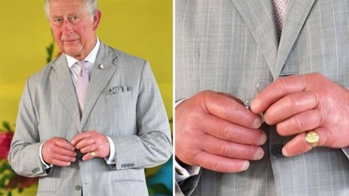 Carlos III: ¿Llegará a su coronación con ''dedos de salchicha''? Esta es la condición que padece