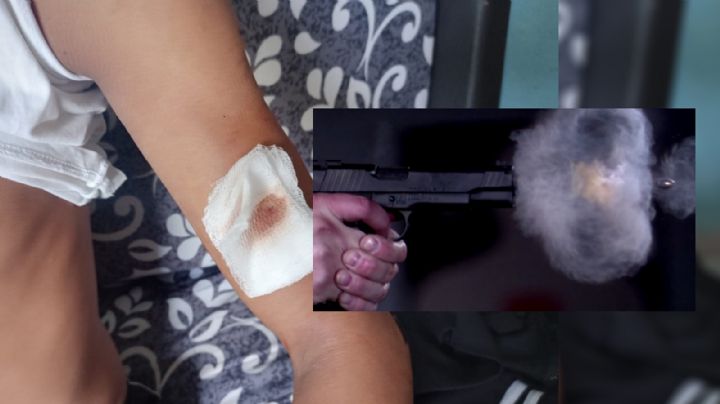 Joven sordomudo pide ayuda tras recibir un balazo en Colonias de Santa Fe