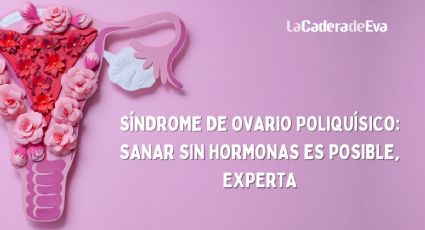 Síndrome de ovario poliquístico: tratamiento sin hormonas es posible, experta