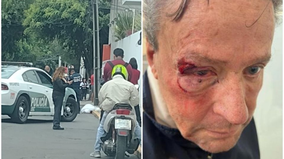 Lesiones de Alfredo Adame por la golpiza sufrida en balacera frente a su casa