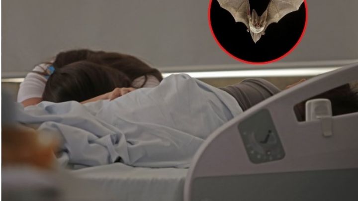 Muere niña contagiada de rabia en Oaxaca