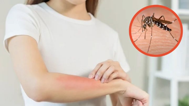 Alarma propagación de dengue en dos municipios de Hidalgo