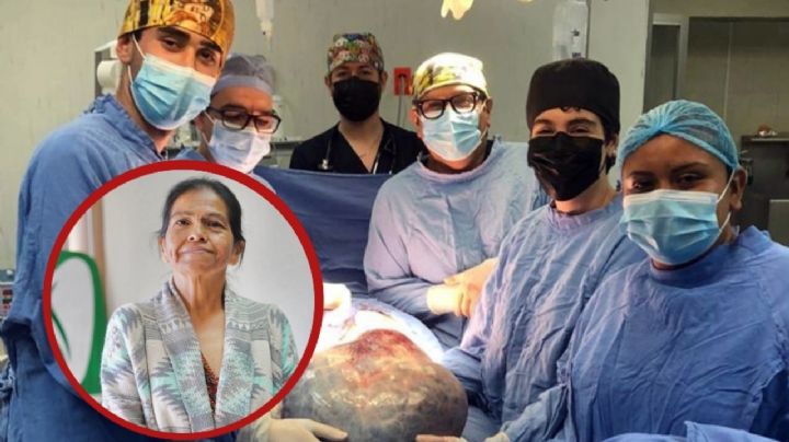 “Ya no podía andar en moto”: tenía tumor de 21 kg