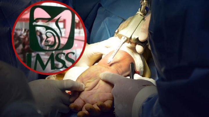 Máquina aplastó la mano a Christian; cada año, 27,000 trabajadores sufren accidentes en Guanajuato