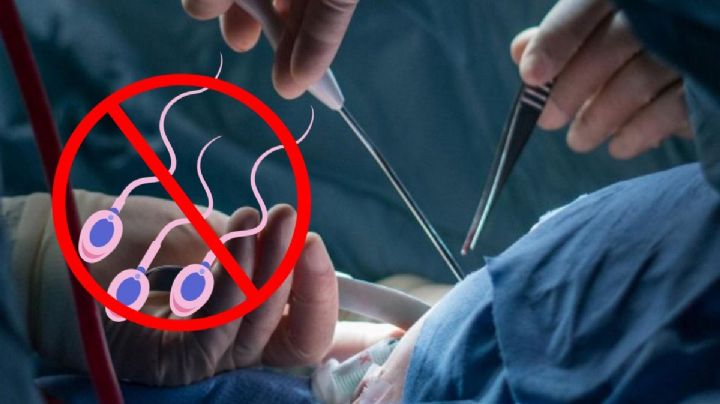 ¿Quieres hacerte la vasectomía? Habrá jornada de salud en Veracruz