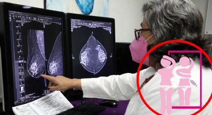 Cáncer de mama en México: a falta de medicamentos se suma falta de especialistas: Auditoría Superior