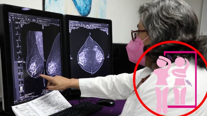 Un día de pago de interés de deuda solventaría 16,571 tratamientos anuales de cáncer de mama