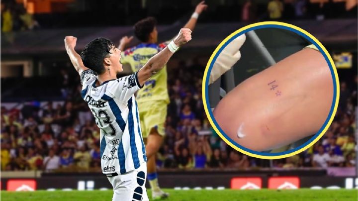 ¿Kevin Álvarez le hizo fuchi al Pachuca? Se tatúa campeonato del América y con los Tuzos no