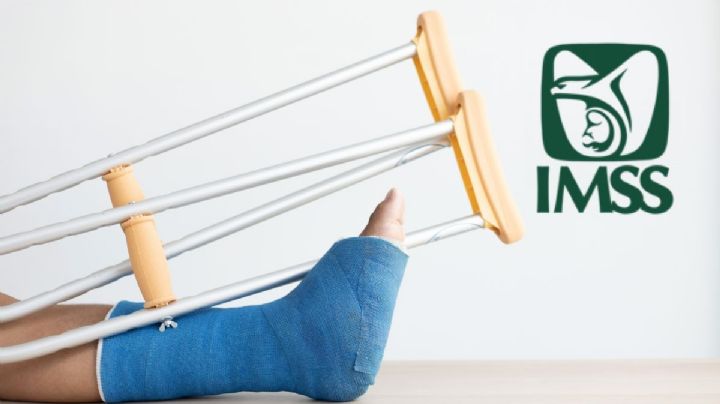 Por error, IMSS de Coatzacoalcos amputó pierna a paciente: CNDH