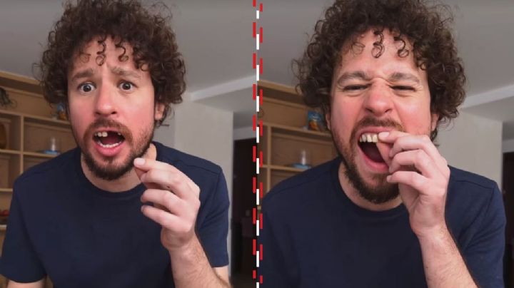 Así fue el momento exacto en el que Luisito Comunica perdió los dientes EN VIVO